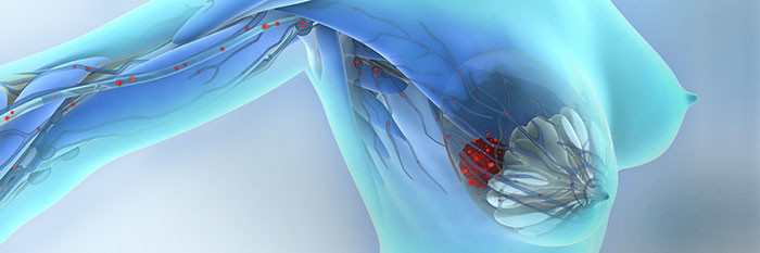 Breast Cancer Liquid Biopsy Market'