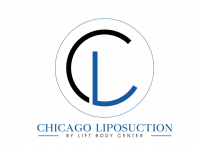 Chicago Liposuction by Lift Body Center Logo