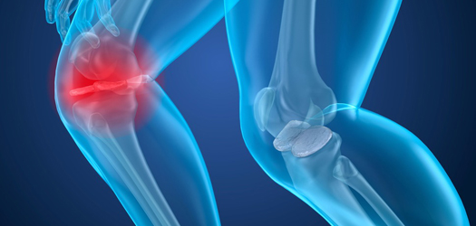 Orthopedic Software Market'
