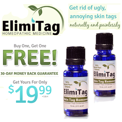 ElimiTag Skin Tag Remover'