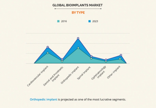 Bioimplants Market Opportunity Analysis'