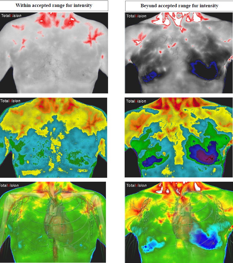 Thermography Near Me'