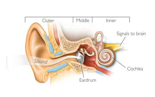 Hearing Loss'