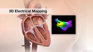 3D Cardiac Mapping System Market'