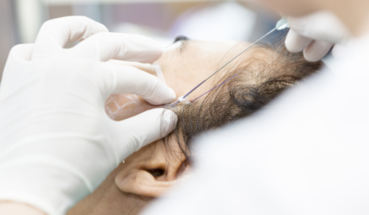 Aesthetic Threads Market