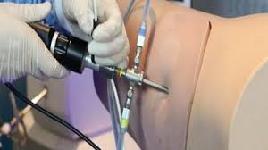 Arthroscopy Devices Market'