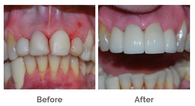 Denture Care Center'