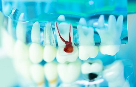 Denture Care Center'