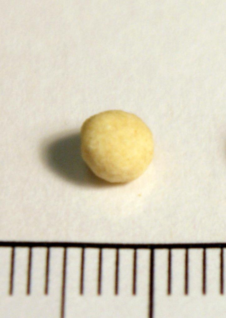 Joel Klenck: Chickpea seed from Locus 3, Area A, Noah's Ark'