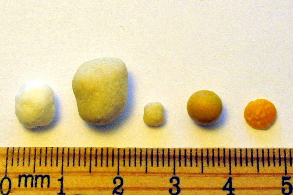 Joel Klenck: Comparison to chickpea seed from Ark of Noah.'