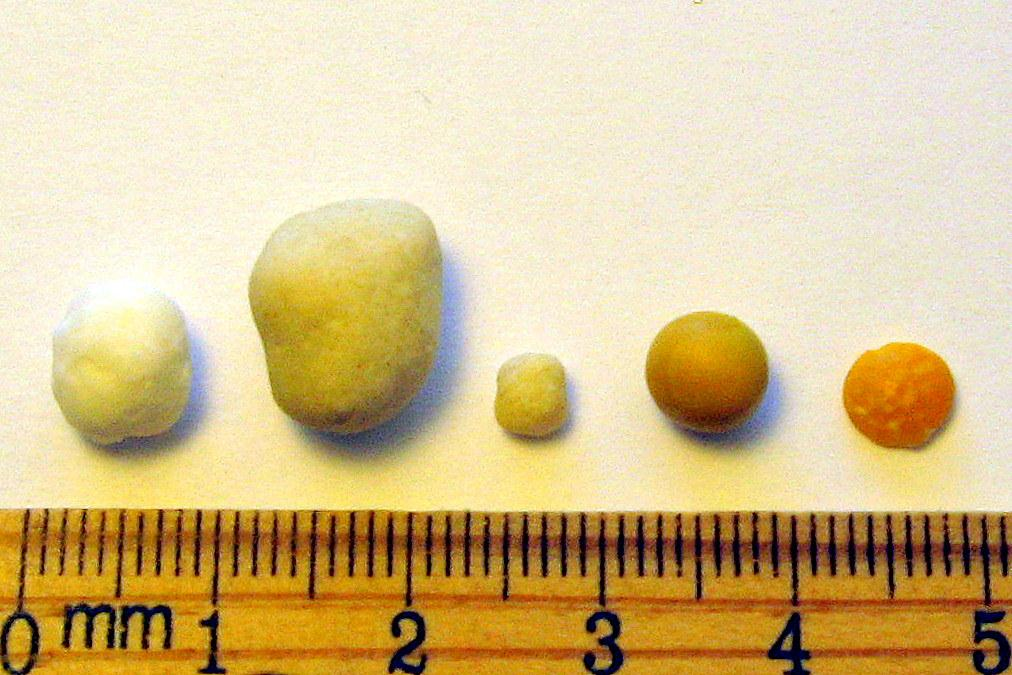 Joel Klenck: Comparison to chickpea from Ark in center.'