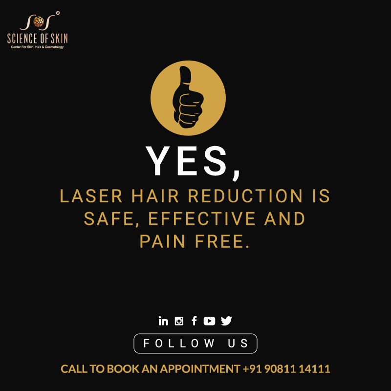 laser hair removal treatment'