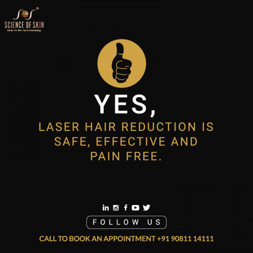 laser hair removal treatment'