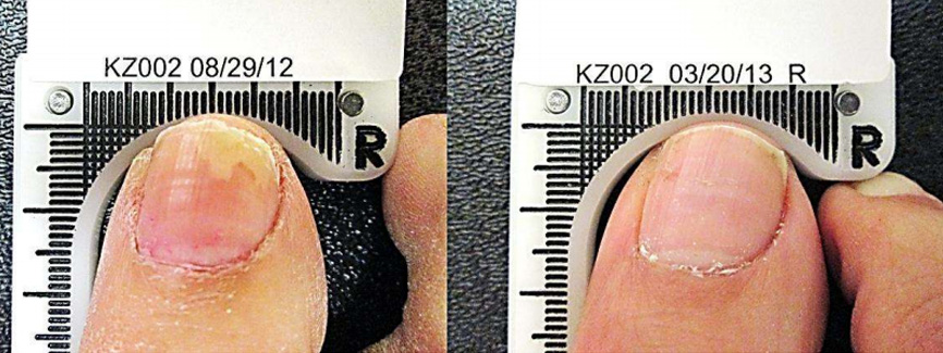 Podiatrist Noosaville'