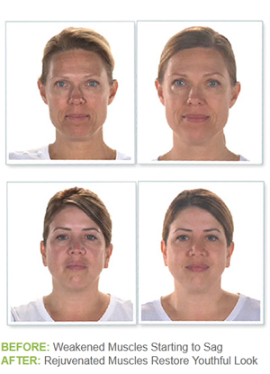 before toner facial releasewire caption results