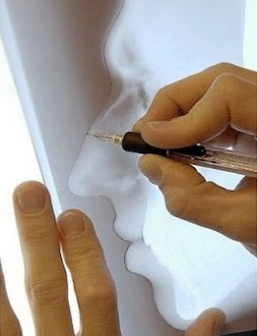 Company Logo For Rhino plasty'