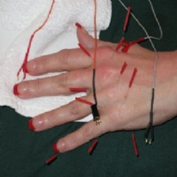 Columbia Acupuncture