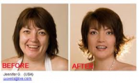 Use Natural Ways to Lose Face Fat Faster