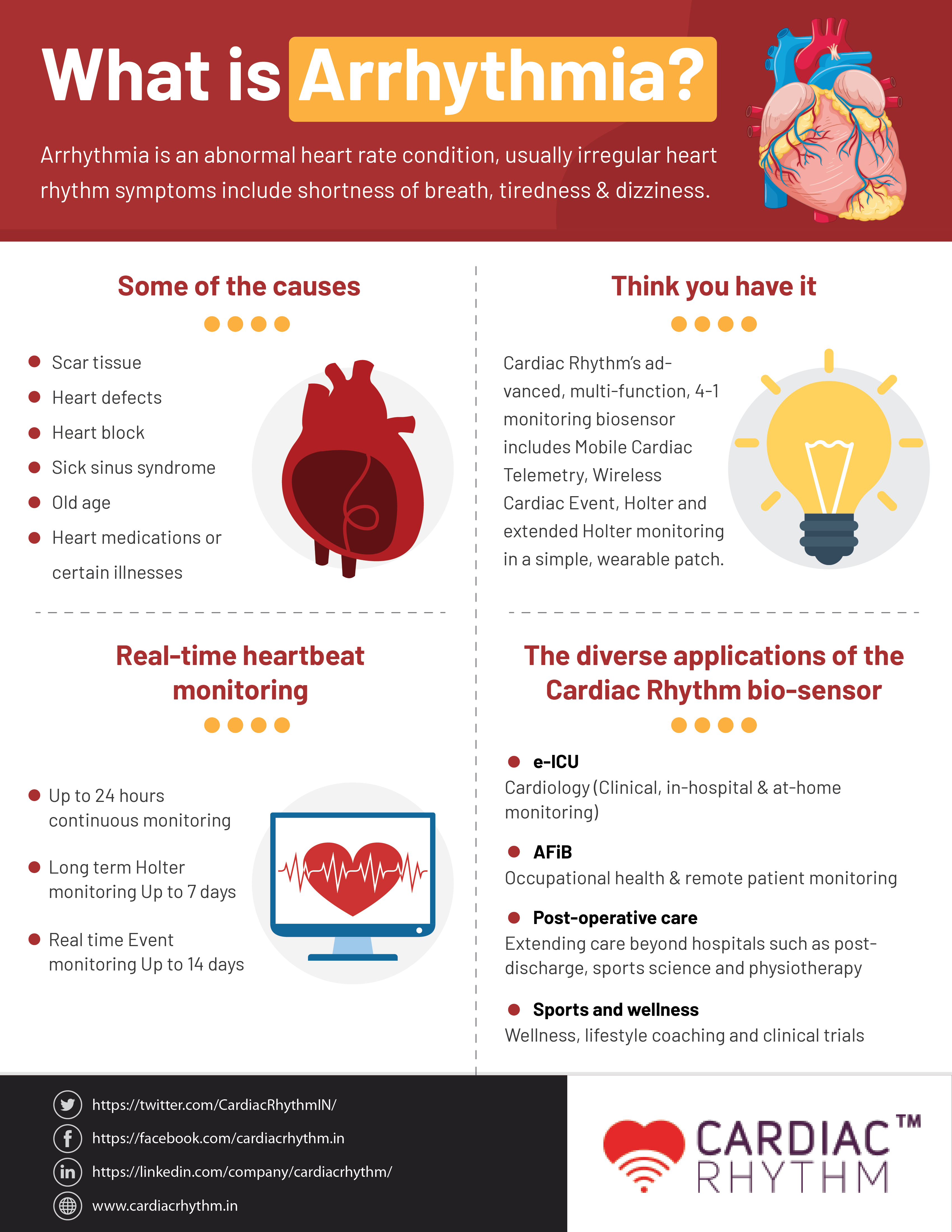What is Arrhythmia?'