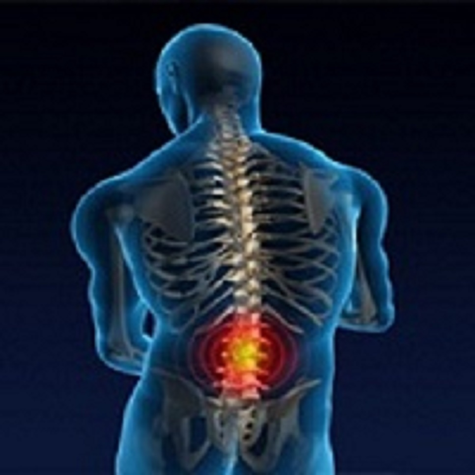 Lower Back Pain'