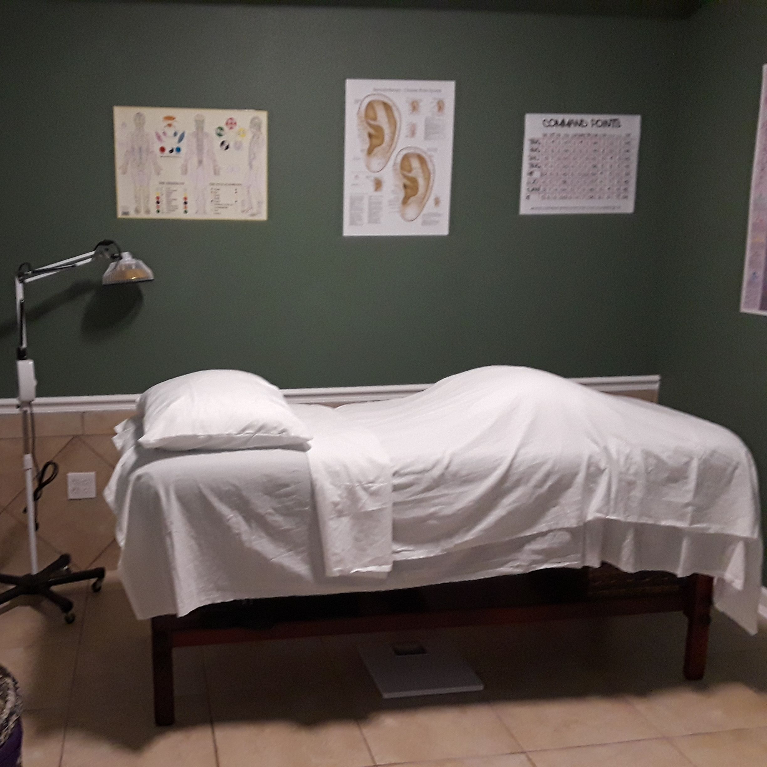 Community Acupuncture'