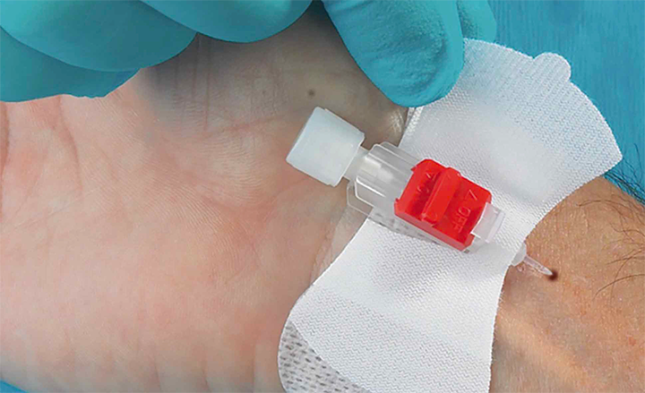 Catheter Securement Devices Market