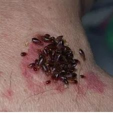 Bed Bug Exterminators'