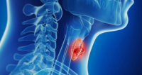Non-Hodgkin Lymphoma Treatment Market Size Is Projected to