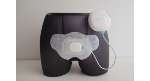 Urinary Incontinence Devices Market: Latest Global Insights'