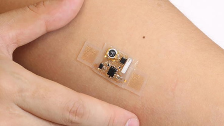 Biosensors Market