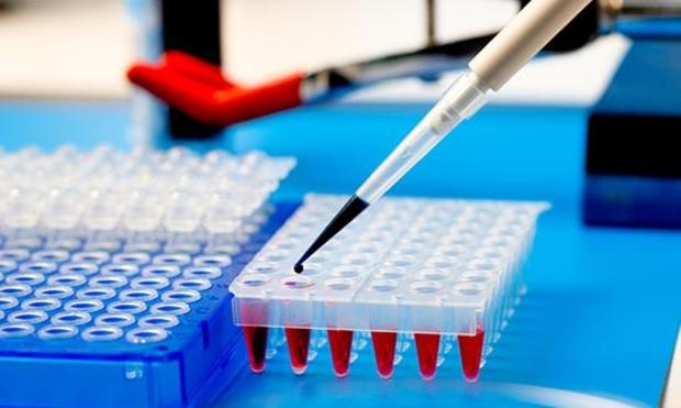 Global  Enzyme-linked Immunosorbent Assay (ELISA) Testing Ma'