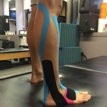 Kinesio Taping'