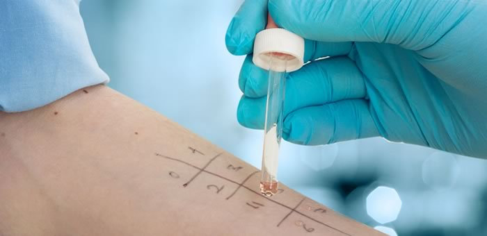 Allergy Immunotherapy Market'