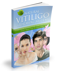 Natural Vitiligo Treatment System'
