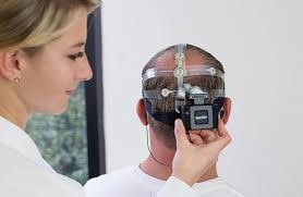 Brain Monitoring Devices Market'