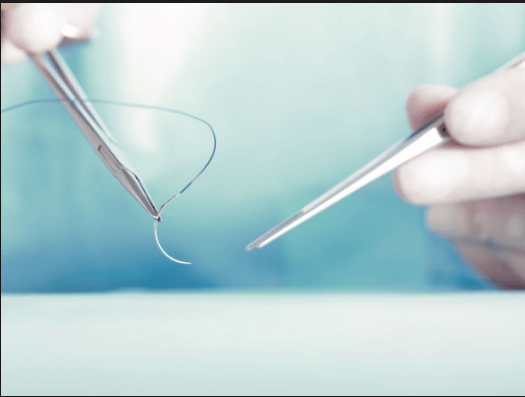 Surgical Sutures Market