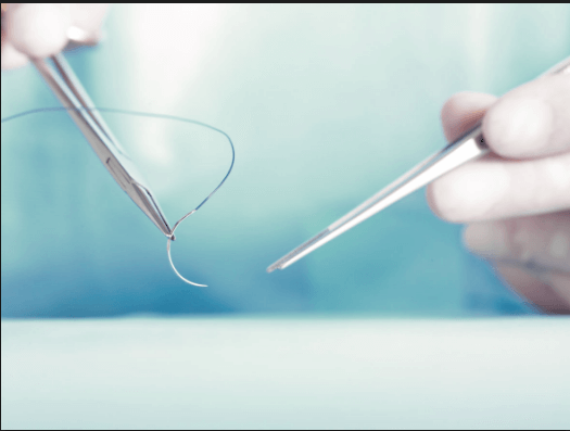 Surgical Sutures Market'