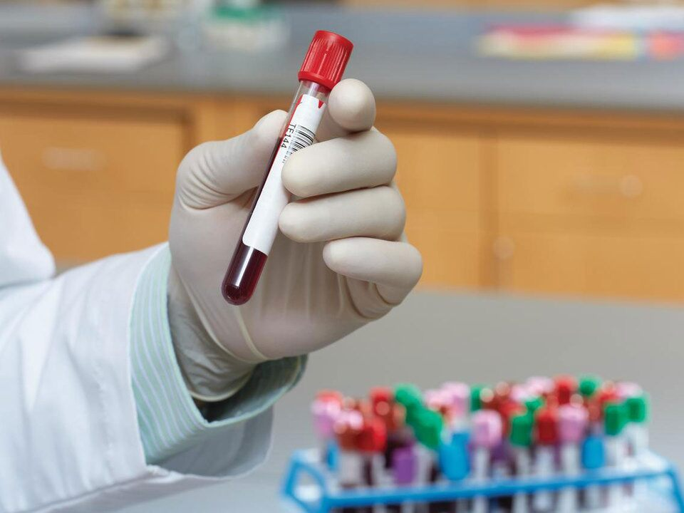 Hepatitis Test Solution/Diagnosis Market