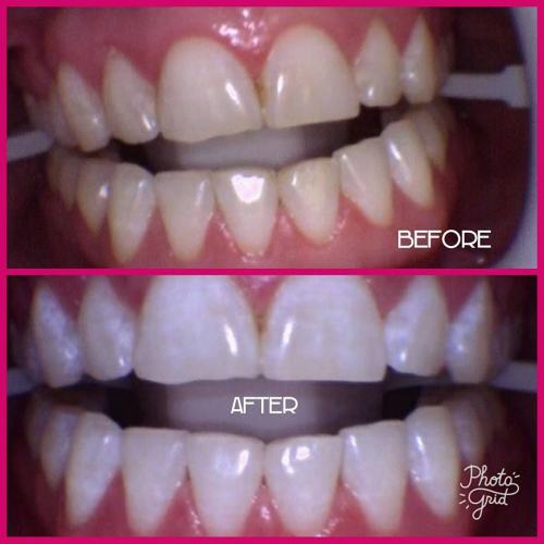 Cosmetic Dentistry'