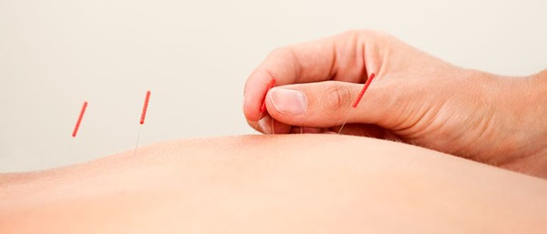 Acupuncture Park Ridge'