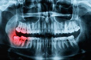 Company Logo For Rockwell Oral and Facial Surgery'