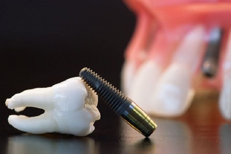 Oral Surgeon'