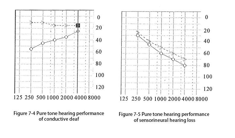 hearing fitting diagram'