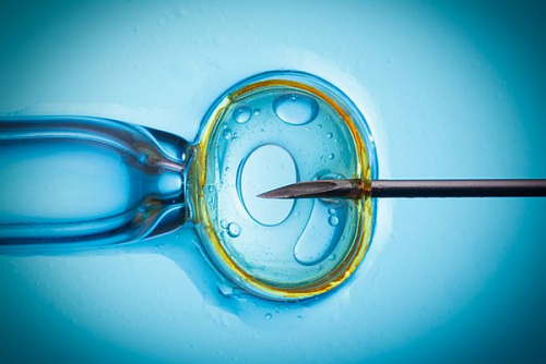 Assisted Reproductive Technology Market'