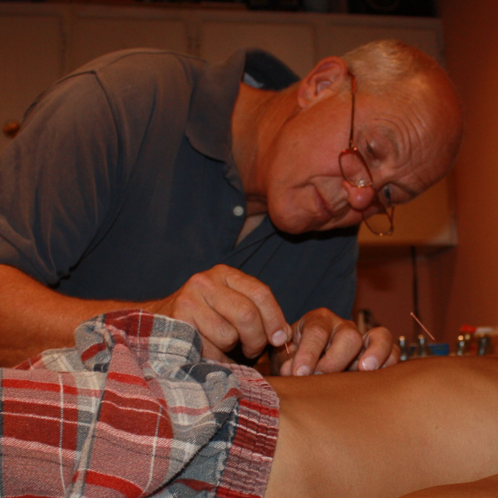 Acupuncture'