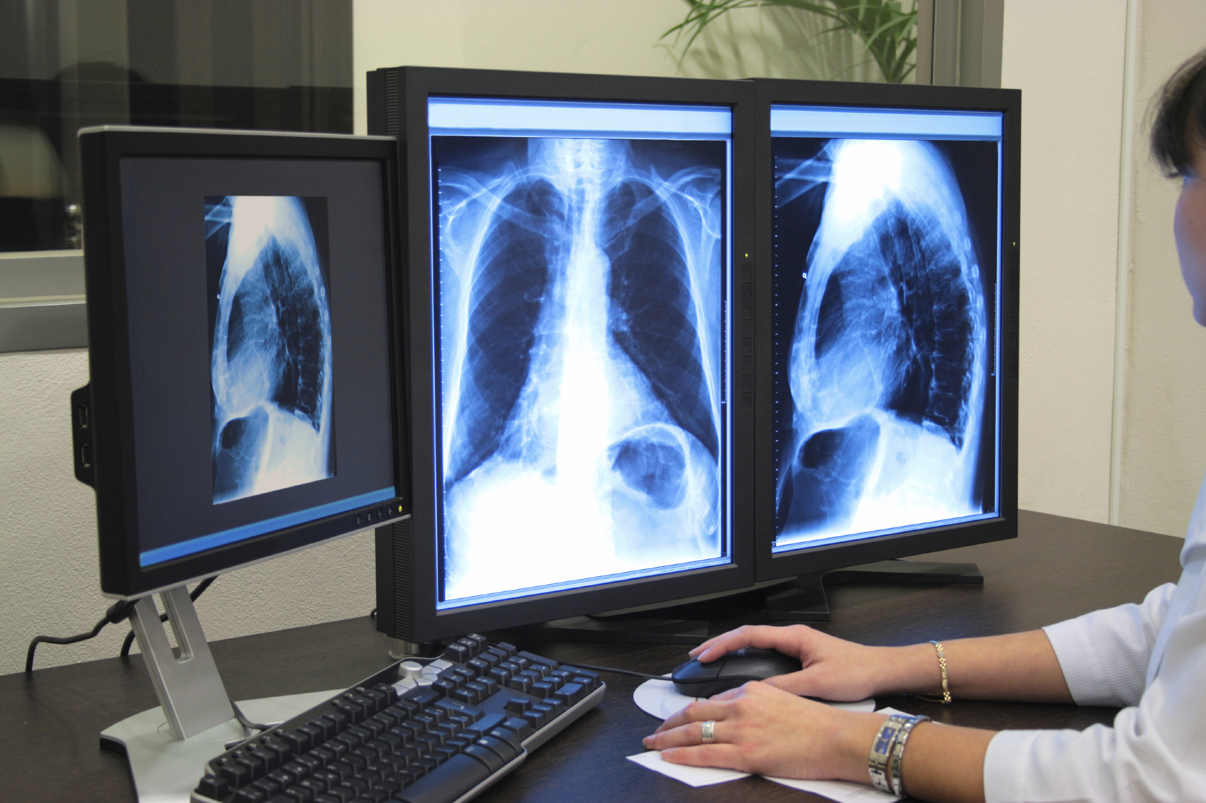 Radiology Information Systems Market