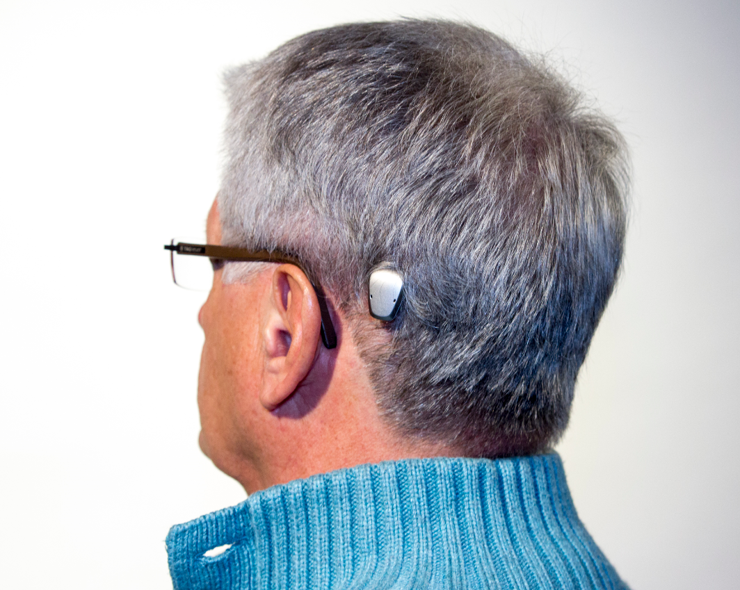 Bone Anchored Hearing Aids Market