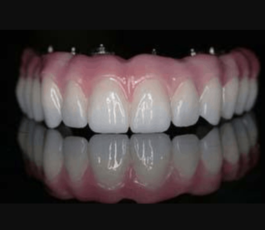 Tijuana Dental Clinics'