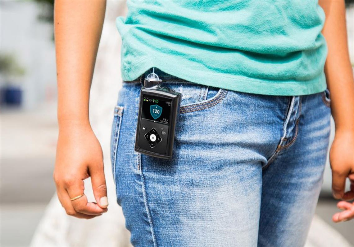 Artificial Pancreas Device System Market