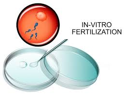 In-Vitro Fertilization Market
